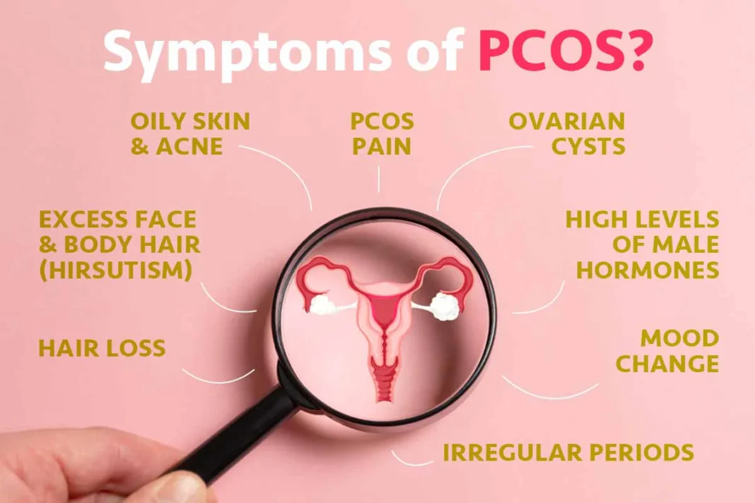pcos symptoms